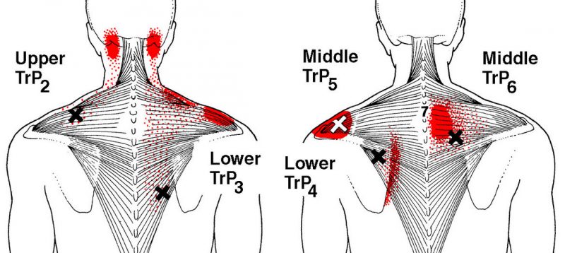 right shoulder back pain home remedies