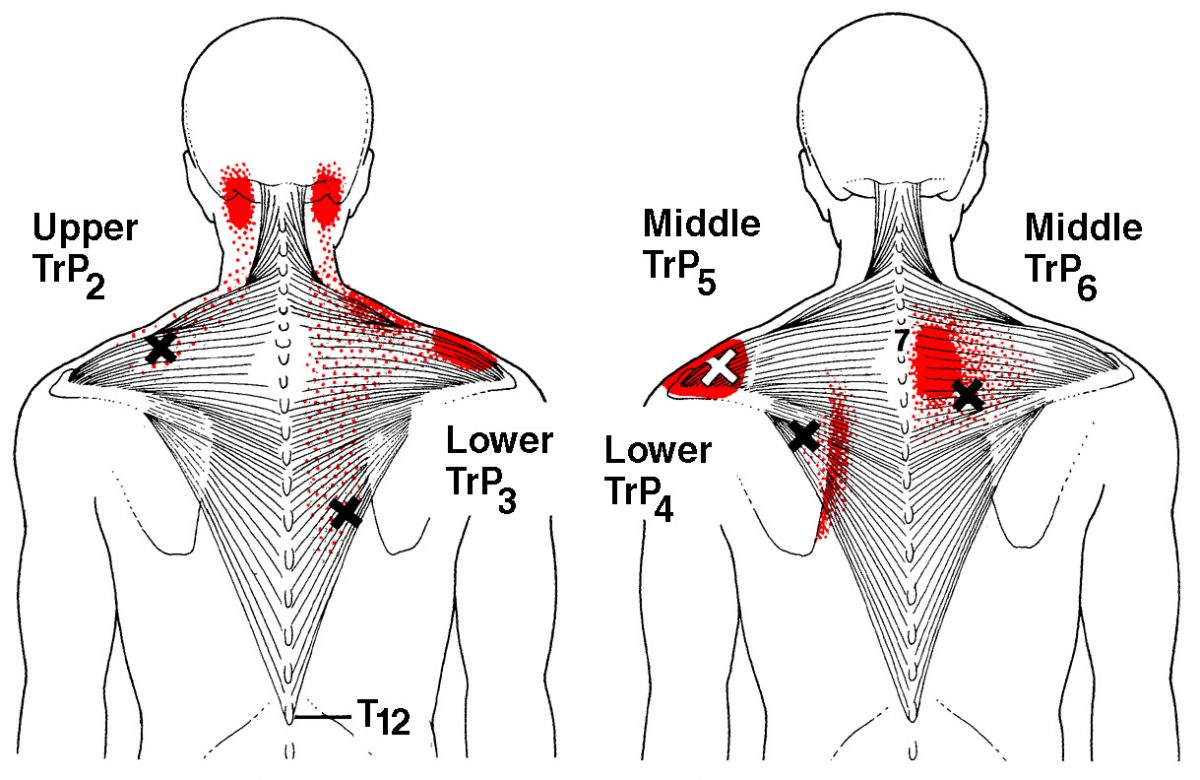 right-side-back-pain-florida-surgery-consultants